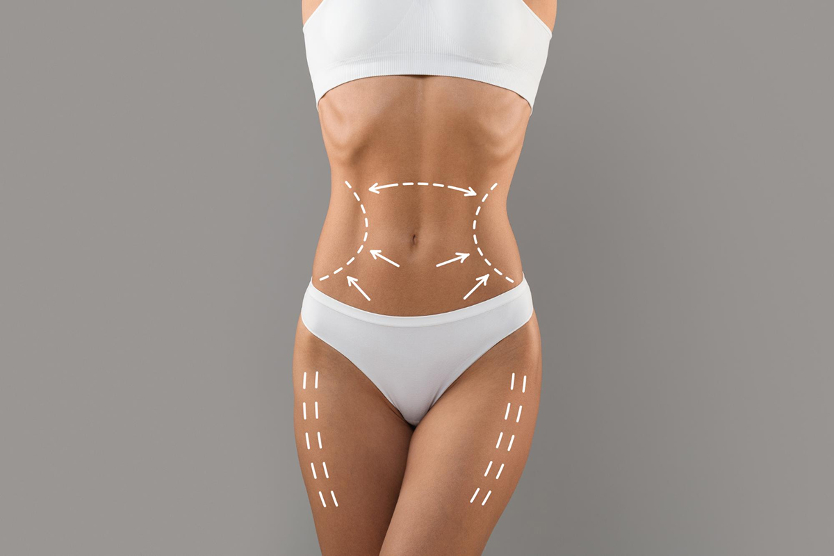 Transform Your Body with Instant Results of Liquid Lipo