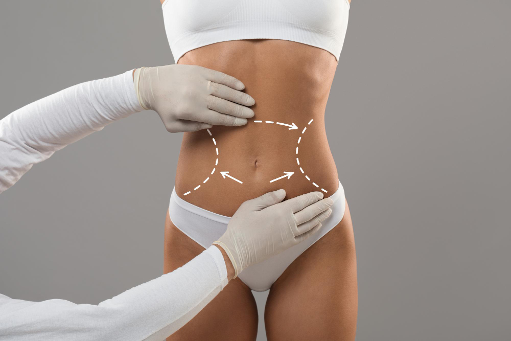 Radiofrequency Fat Reduction That Works