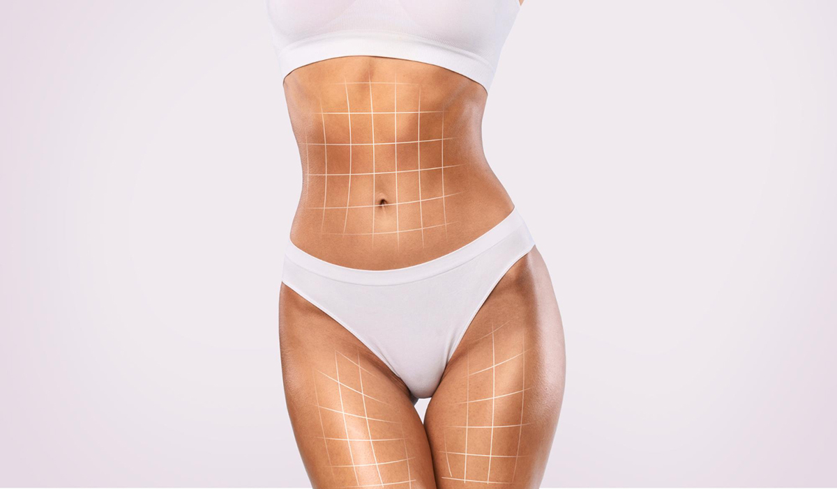 Is Liquid Lipo Right For You?