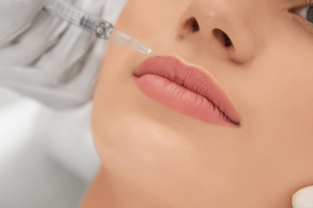 What You Need To Know about Dermal Fillers