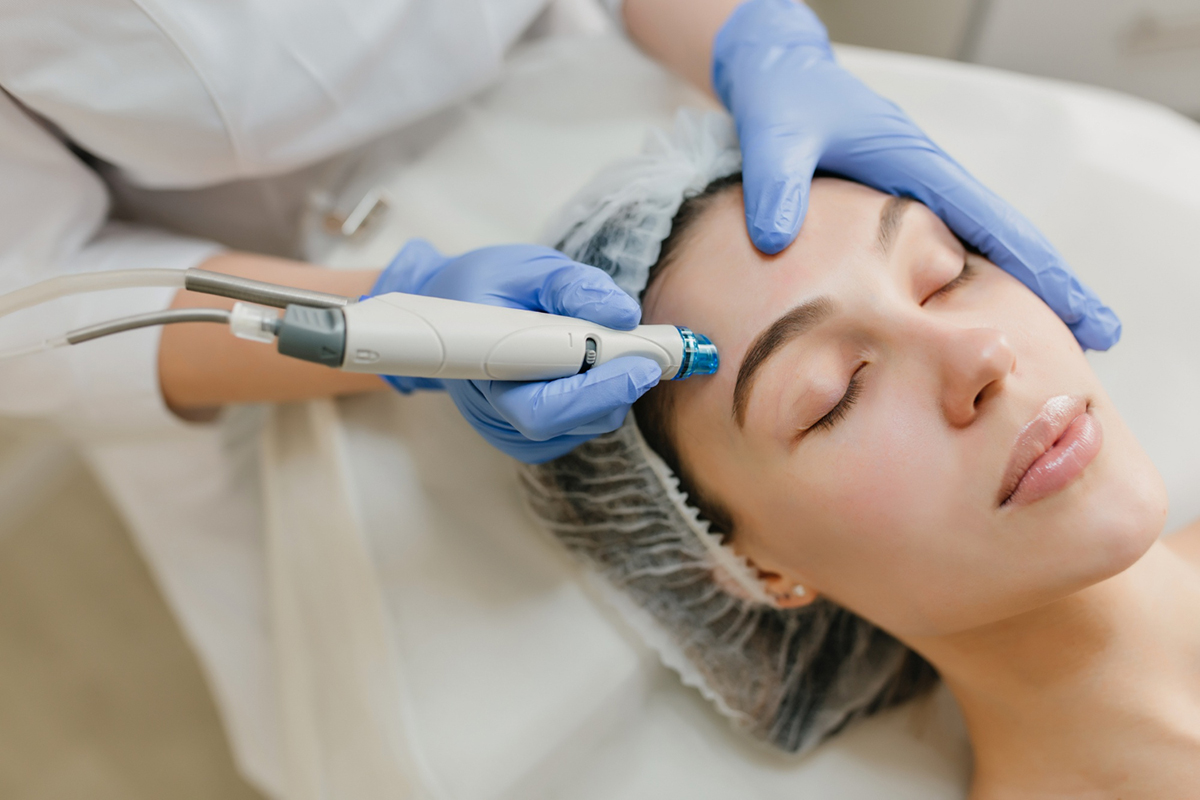 Reasons How Microneedling Can Benefit Your Face
