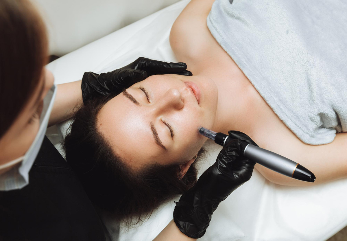 Reasons Microneedling Is So Beneficial for Your Skin