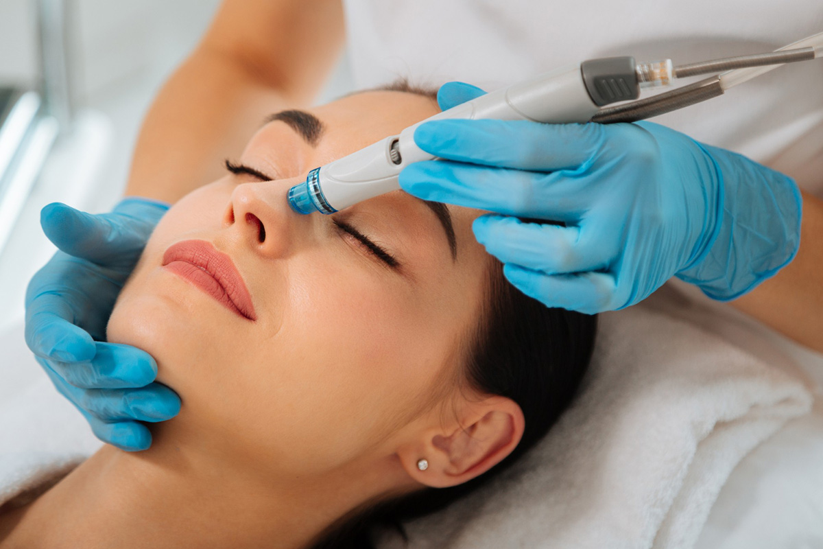 The Ins and Outs of Microneedling Treatment