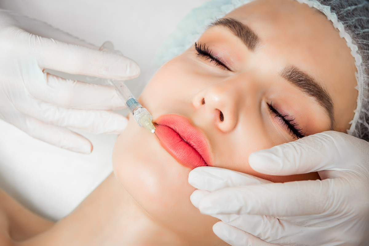 Discover the Unexpected Benefits of Lip Filler