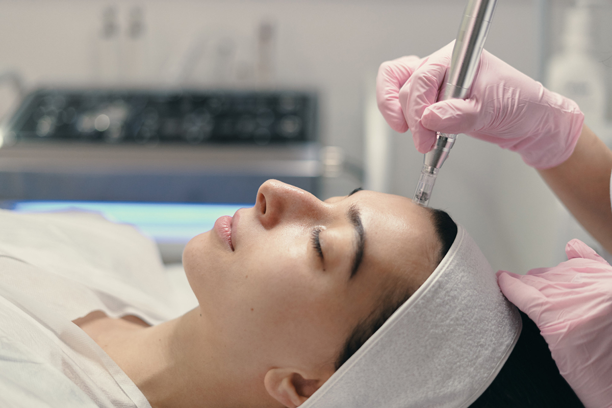 Achieve Clear Skin with Microneedling: How it Helps with Acne Scars