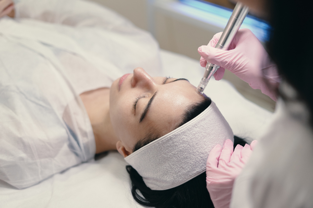 Can You Have Fillers at the Same Time as Microneedling?