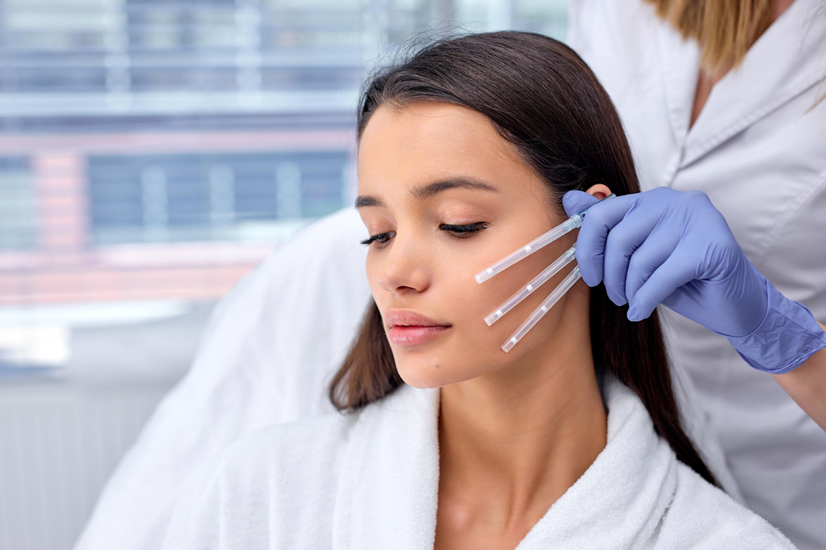PDO Threads- The Ultimate Solution to Skin Rejuvenation