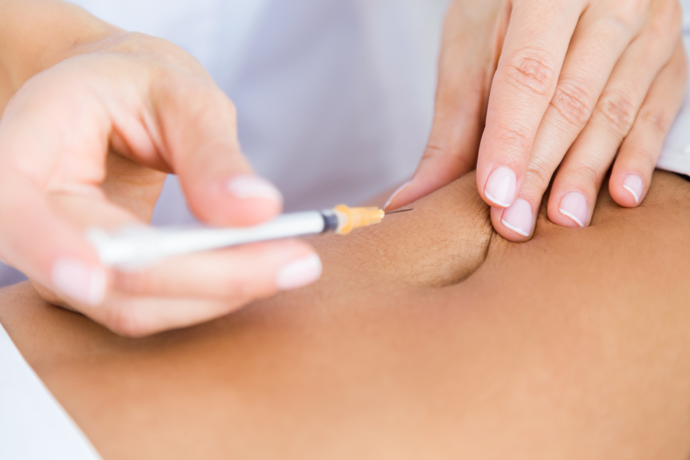 Most Common Questions About Liquid Liposuction Answered