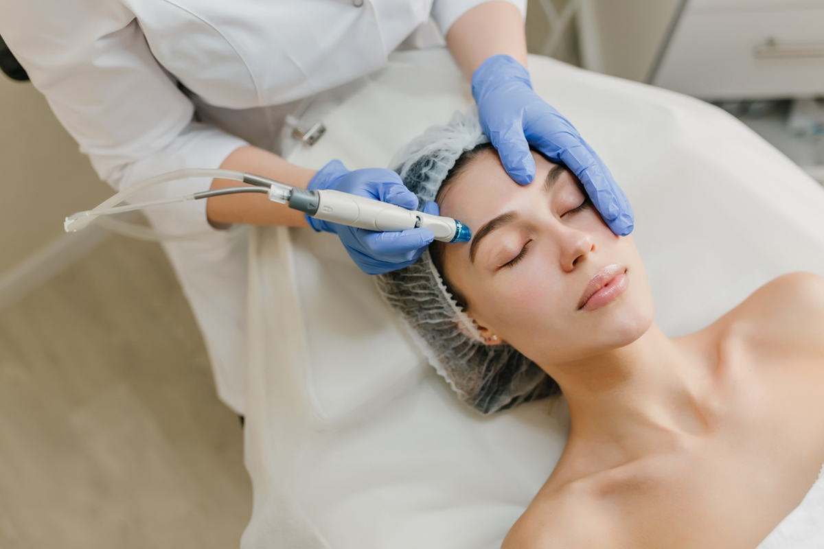 Why Microneedling Treatment is Worth Trying