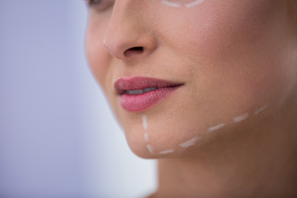 Top Uses for Sculptra