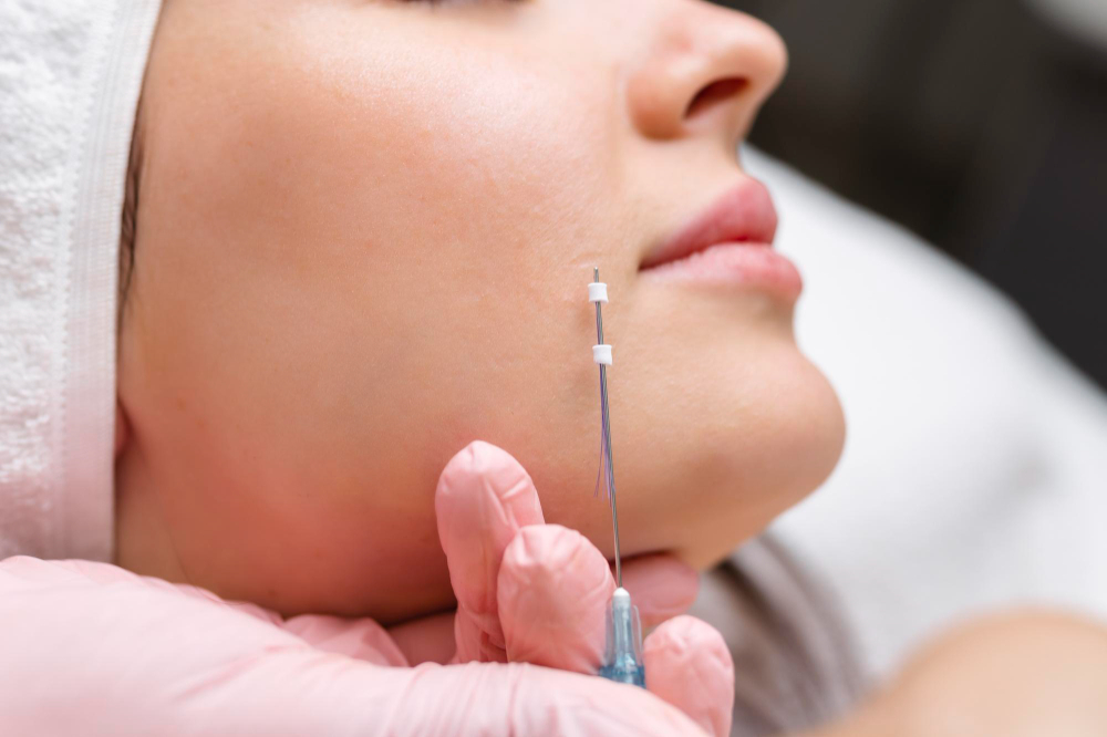 The Science of Youthful Firmness: How PDO Thread Lift Works