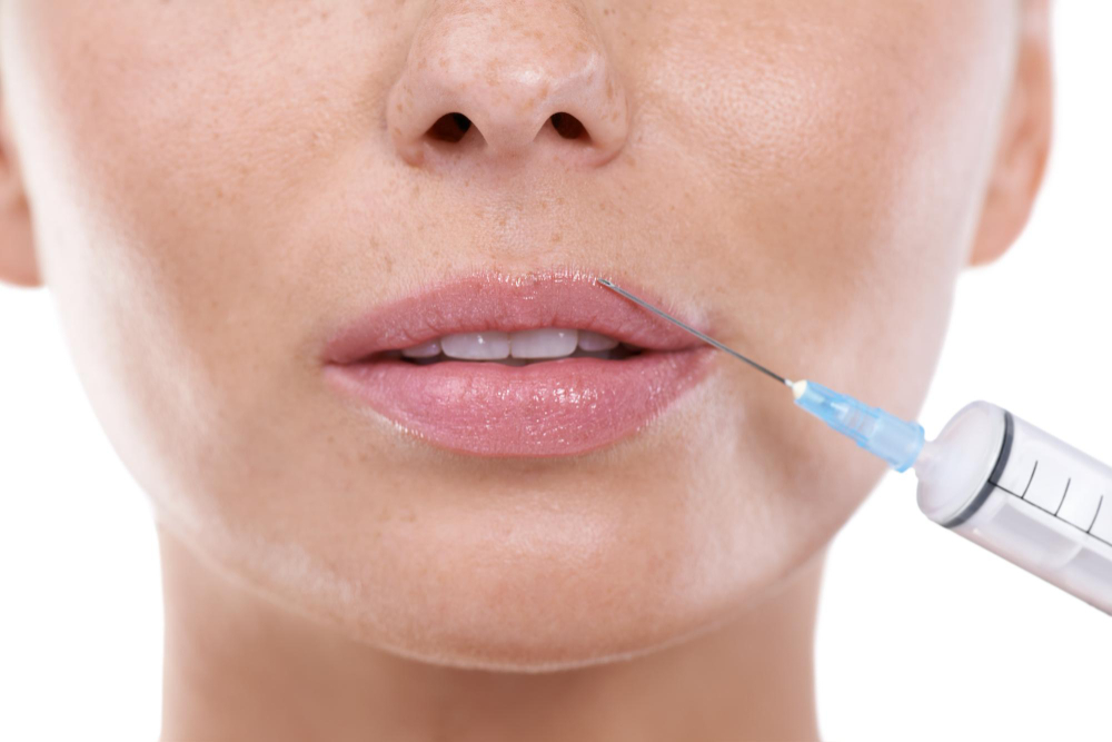 The Complementary Canvas: Innovating With Fillers in Aesthetic Medicine