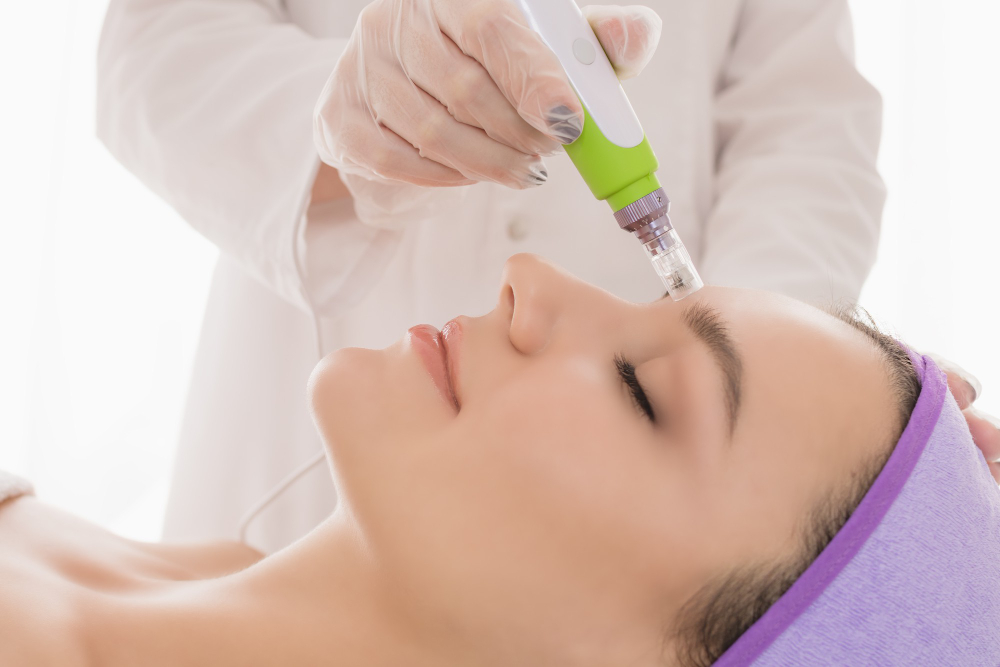 Microneedling: Your Ultimate Q&A Guide