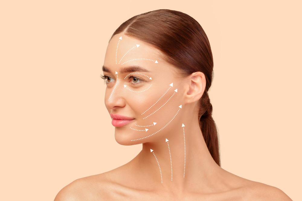 Understanding Collagen Stimulation in PDO Threads
