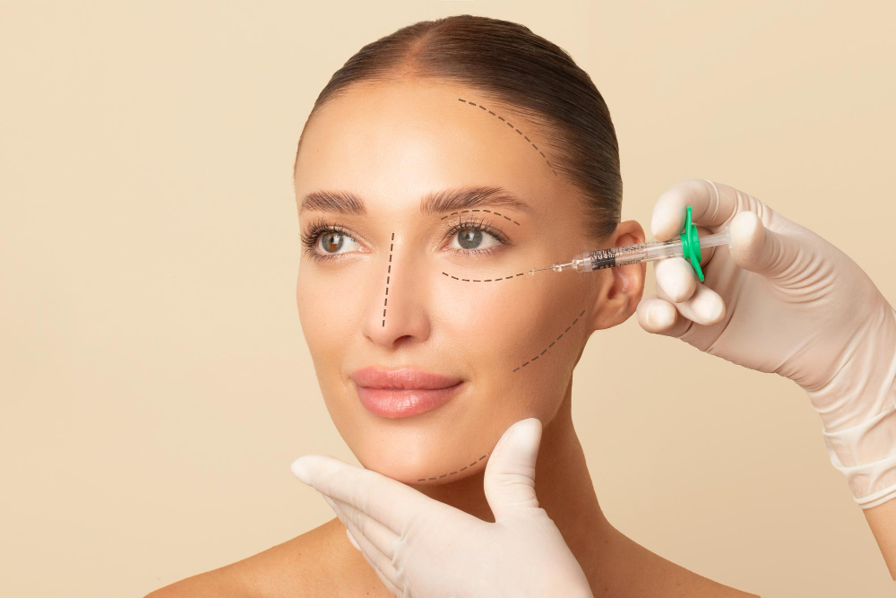 Transform Your Look with Radiesse: The Ultimate Guide