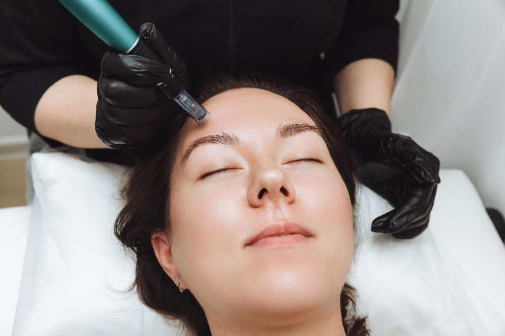 How Microneedling Affects Your Skin Barrier