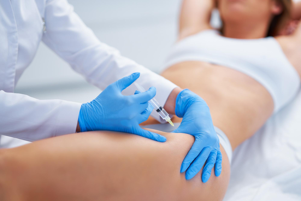 Preparing for Liquid Lipo: Expert Tips You Need to Know