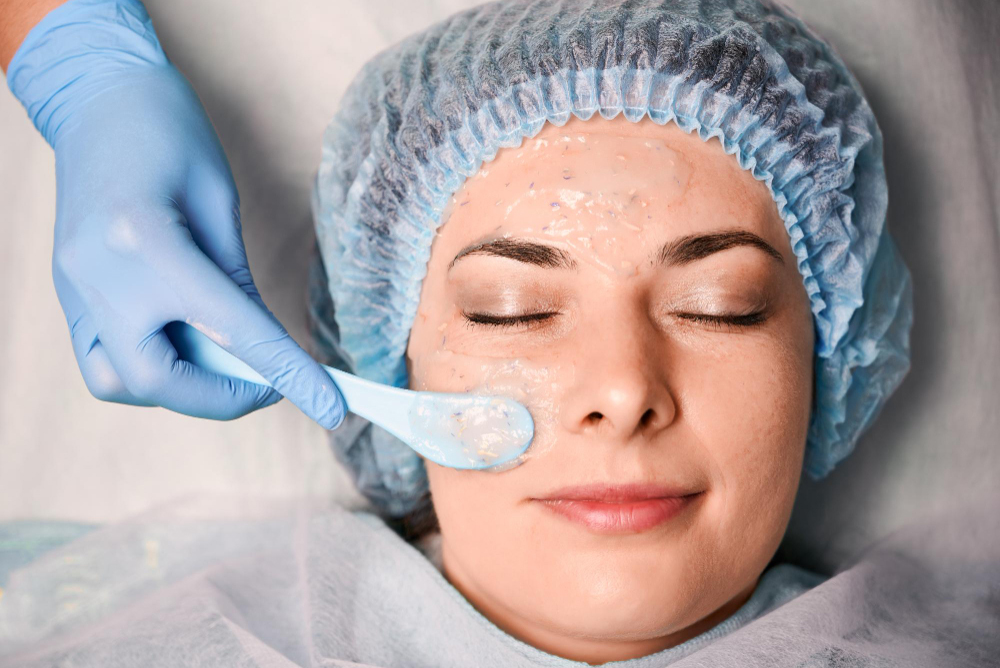 Chemical Peels Explained: Light, Medium, and Deep Options