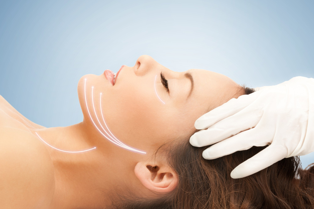 PDO Thread Lifts: Areas of the Face They Can Treat