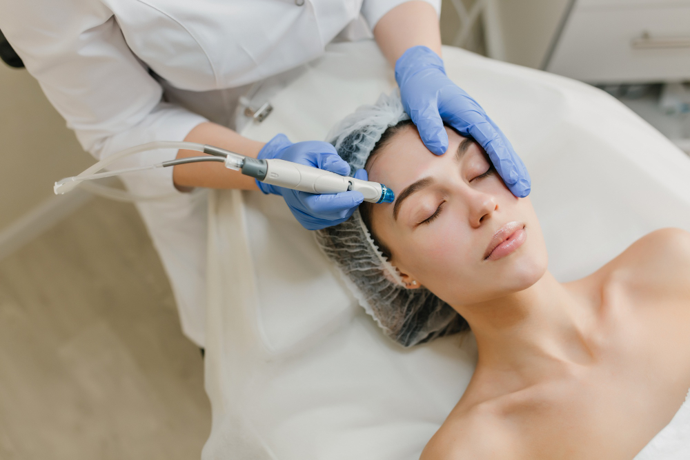 Why Microneedling Is Your Skin's Best-Kept Secret