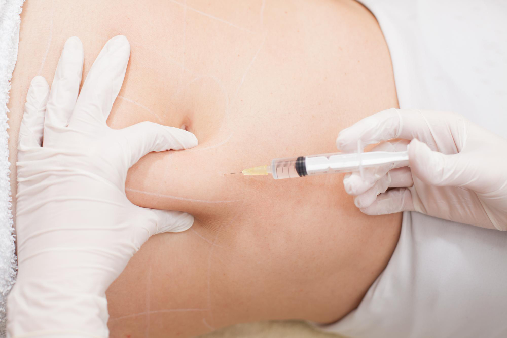 What Is Liquid Lipo and How Does It Work?