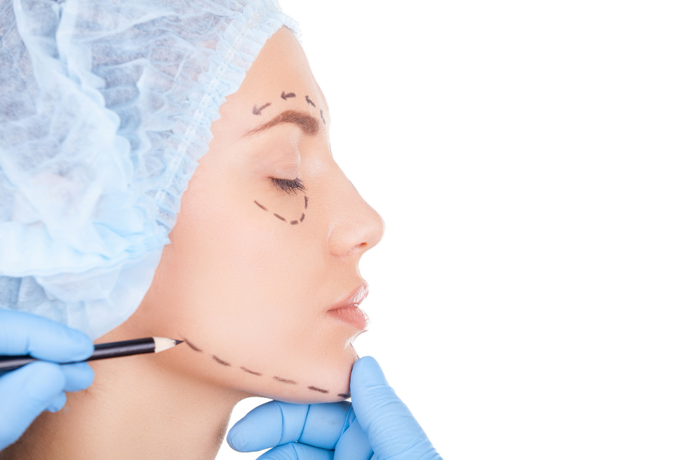 How Many Sculptra Treatments Do You Need? A Complete Guide