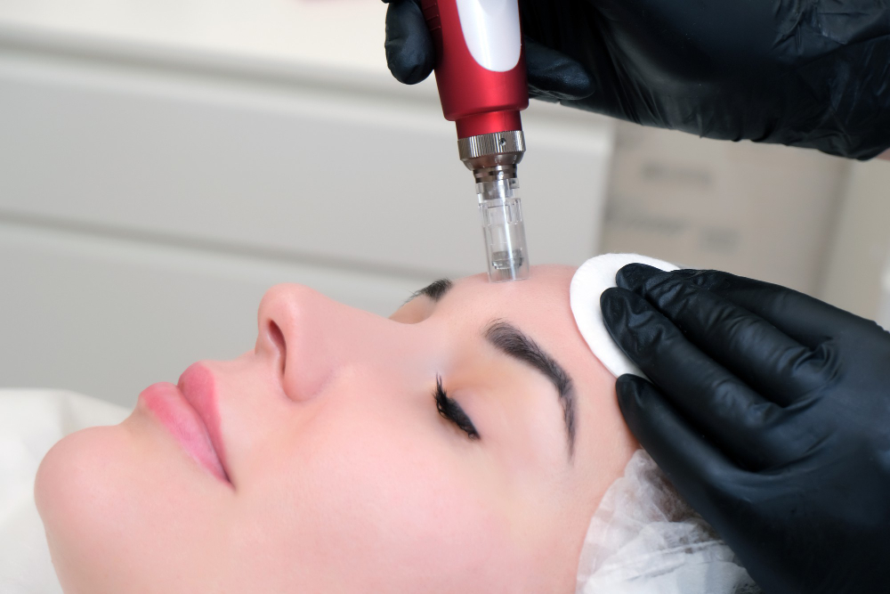Your Complete Guide to Microneedling Aftercare
