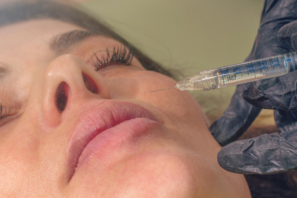 What Does Radiesse Treat? A Comprehensive Guide to This Innovative Filler