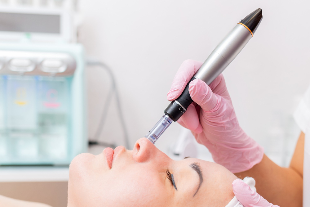 Microneedling vs. Other Treatments: Which is Right for You?