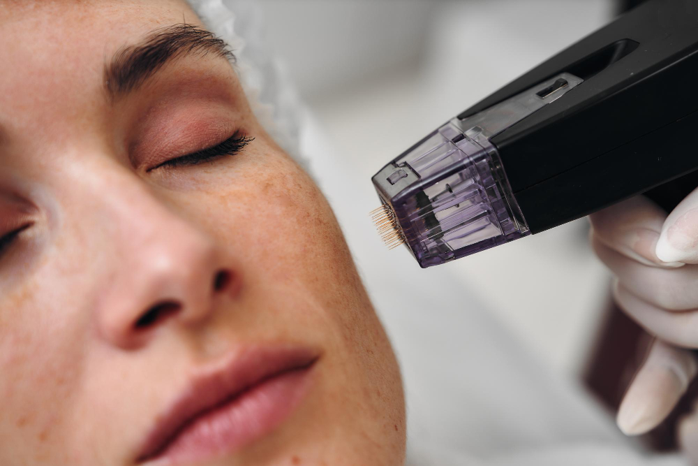 The Science of Microneedling: A Deep Dive