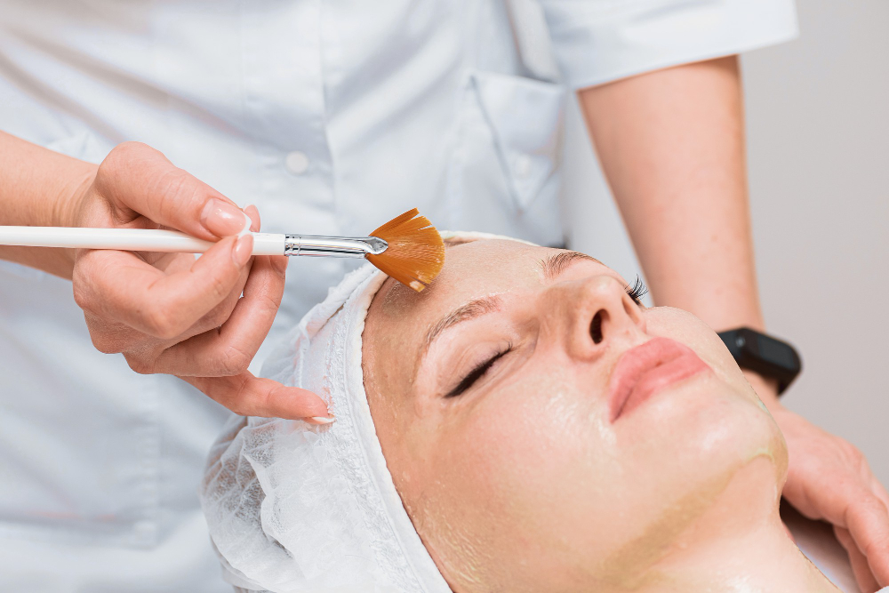 The Ultimate Guide to Caring for Your Skin After a Chemical Peel