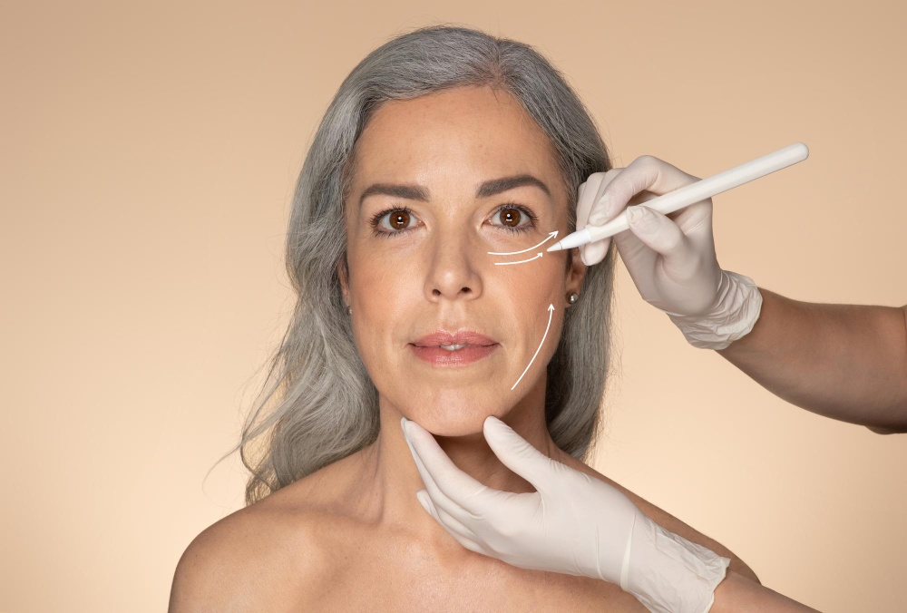 PDO Threads: The Non-Surgical Solution for Wrinkle Reduction