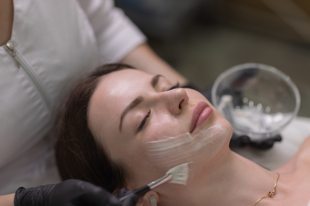 How to Prepare Your Skin for a Chemical Peel