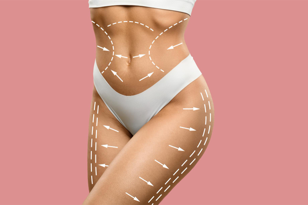 Liquid Lipo Treatment Areas: What You Need to Know