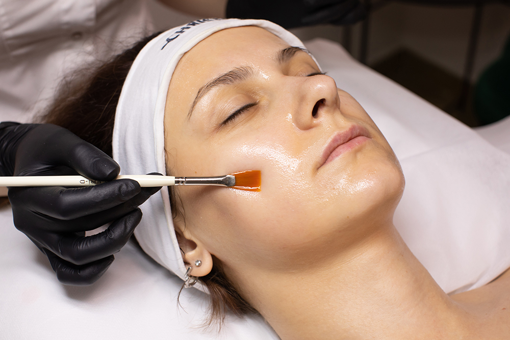 Chemical Peels vs. Laser Treatments: Your Complete Guide