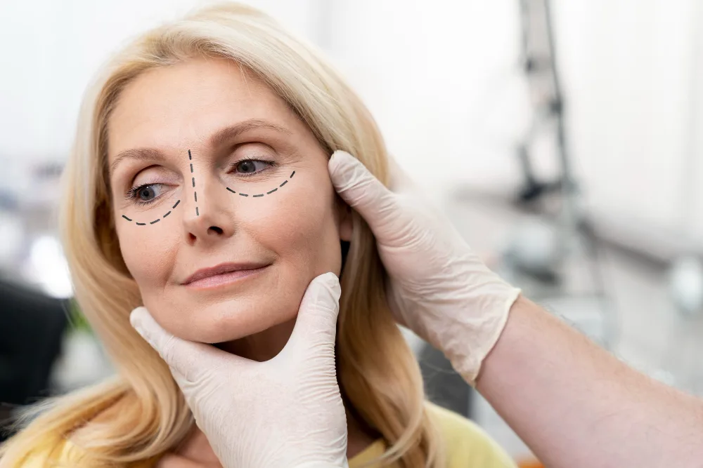 Everything You Need to Know About Under Eye Fillers