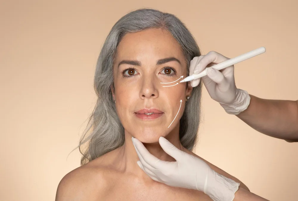 PDO Threads: The Non-Surgical Solution for Wrinkle Reduction