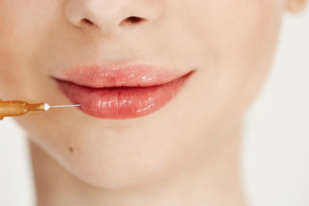 Lip Filler Trends: From Subtle Enhancements to Bold Looks