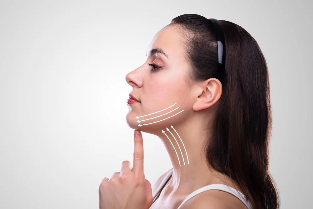 PDO Thread Lift: Myths vs. Facts
