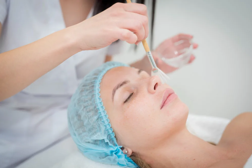 How Chemical Peels Can Help Treat Hyperpigmentation