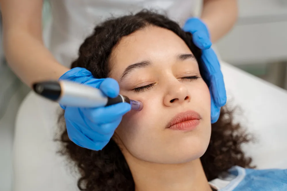 Things You Should Expect Before & After Microneedling