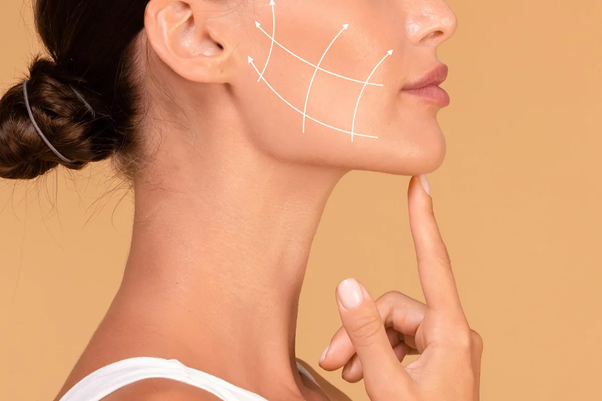 Achieving Stunning Facial Contours with Radiesse