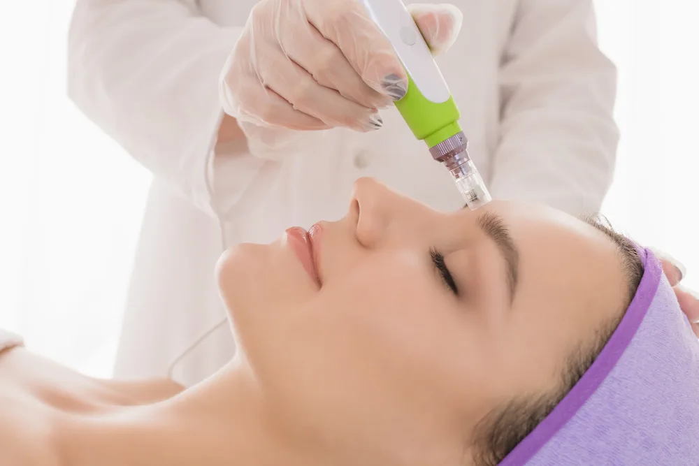 Discover the Benefits of Microneedling for Scars and Uneven Skin Tone