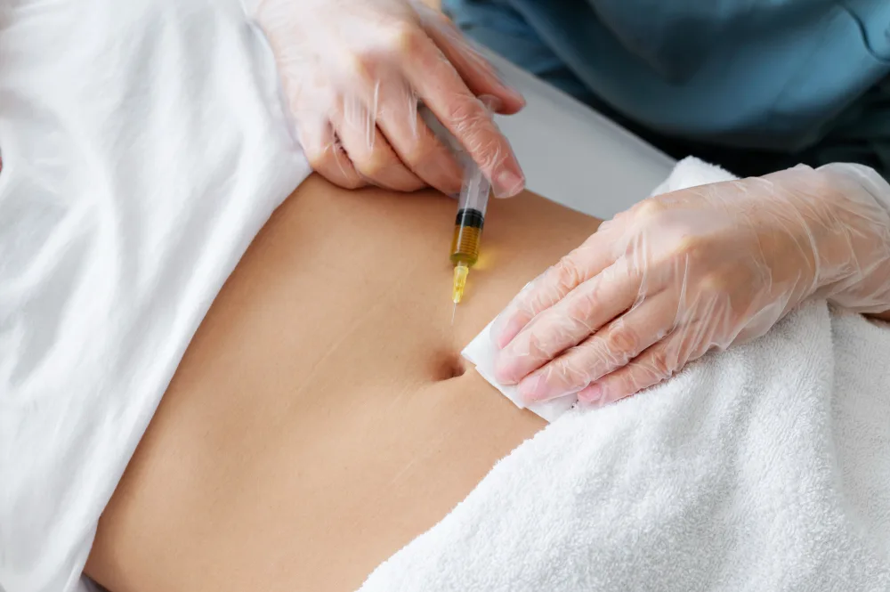What to Expect Before Liquid Liposuction