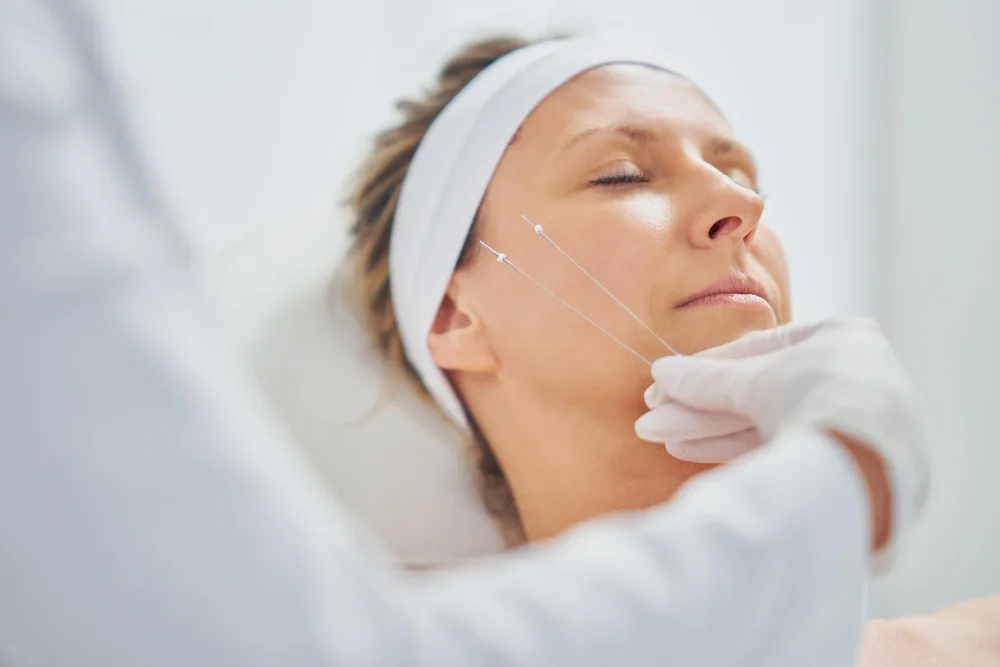 How Long Does a PDO Thread Lift Last?