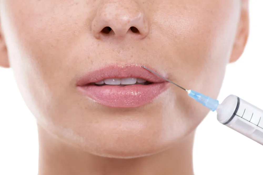 The Complementary Canvas: Innovating With Fillers in Aesthetic Medicine